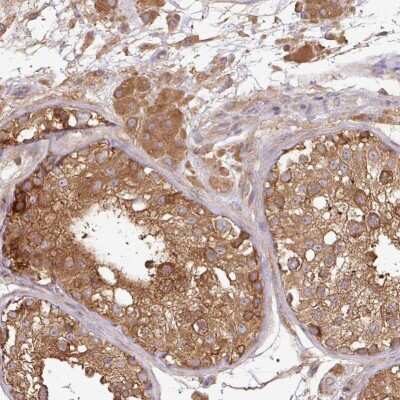 Immunohistochemistry-Paraffin: GSPT1 Antibody [NBP2-47442]