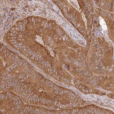 Immunohistochemistry-Paraffin: GSPT1 Antibody [NBP2-47442]
