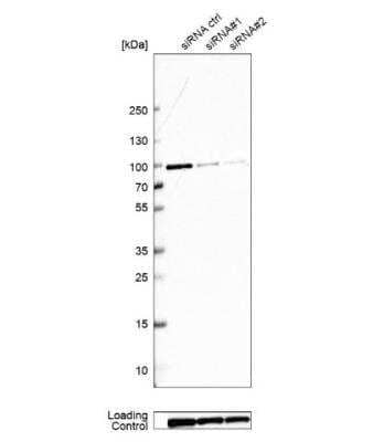 Western Blot: GSPT1 Antibody [NBP2-47442]