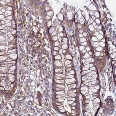 Immunohistochemistry-Paraffin: GSPT2 Antibody [NBP1-91971]