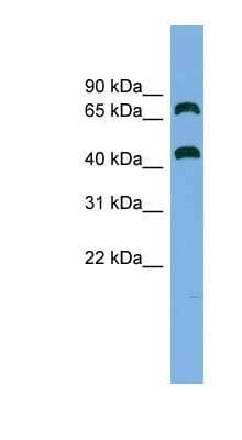 Western Blot: GSPT2 Antibody [NBP1-57646]