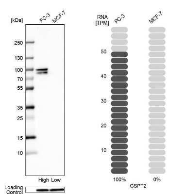 Western Blot: GSPT2 Antibody [NBP1-91971]