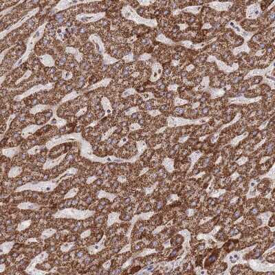 Immunohistochemistry-Paraffin: GST Epitope Tag Antibody [NBP2-14074]