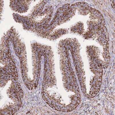 Immunohistochemistry-Paraffin: GST Epitope Tag Antibody [NBP2-14074]