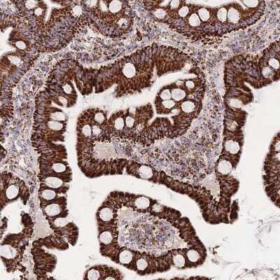 Immunohistochemistry-Paraffin: GST Epitope Tag Antibody [NBP2-14074]