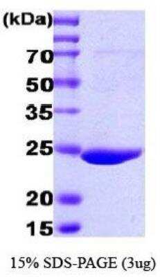 SDS-PAGE: Recombinant GST Epitope Tag Protein [NBC1-18537]