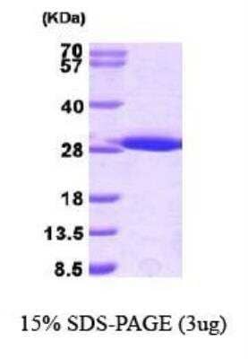 SDS-PAGE: Recombinant Mouse GST Epitope Tag His Protein [NBP1-30276]