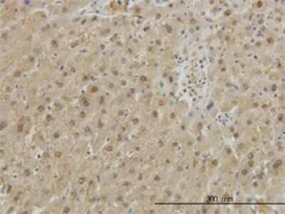 Immunohistochemistry-Paraffin: GSTA1 Antibody (2F7) [H00002938-M01]