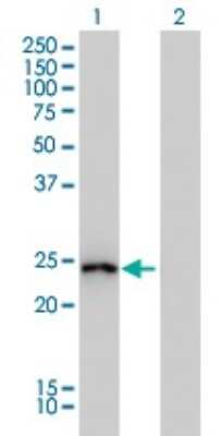 Western Blot: GSTA1 Antibody (2F7) [H00002938-M01]