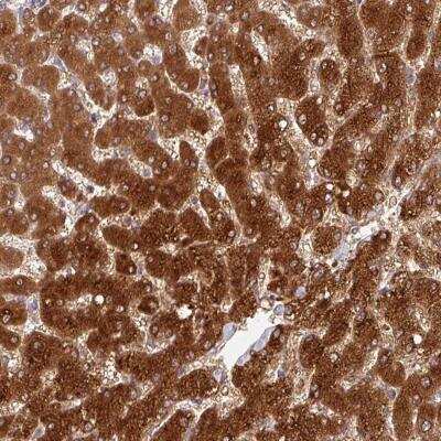 Immunohistochemistry: GSTA1 Antibody [NBP2-46763]