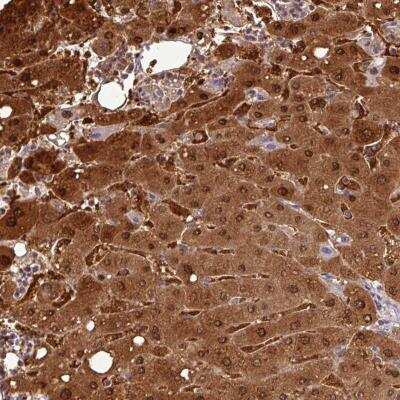 Immunohistochemistry: GSTA1 Antibody [NBP2-46817]