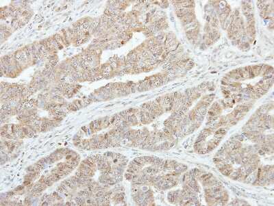 Immunohistochemistry-Paraffin: GSTA1 Antibody [NBP1-32233]
