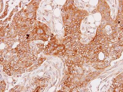 Immunohistochemistry-Paraffin: GSTA1 Antibody [NBP1-33586]