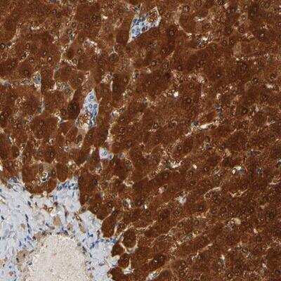 Immunohistochemistry-Paraffin: GSTA1 Antibody [NBP2-59732]