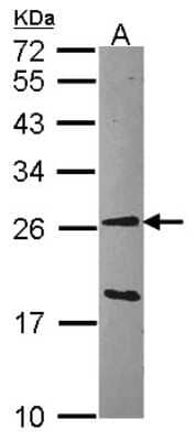 Western Blot: GSTA1 Antibody [NBP1-32233]