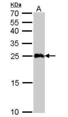 Western Blot: GSTA1 Antibody [NBP1-32233]