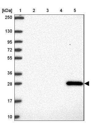 Western Blot: GSTA1 Antibody [NBP2-46817]