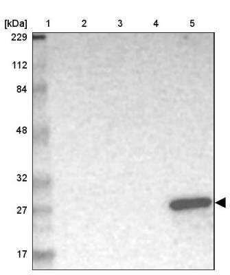 Western Blot: GSTA1 Antibody [NBP2-59732]