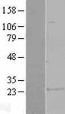 Western Blot: GSTA1 Overexpression Lysate [NBL1-11366]