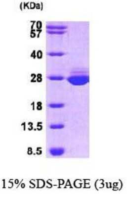 SDS-PAGE: Recombinant Human GSTA1 Protein [NBP1-30307]