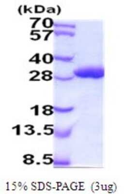 SDS-PAGE: Recombinant Mouse GSTA1 His Protein [NBP2-52089]