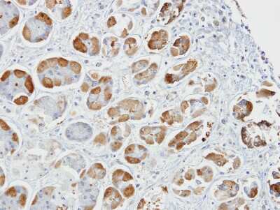 Immunohistochemistry-Paraffin: GSTA2 Antibody [NBP1-32157]