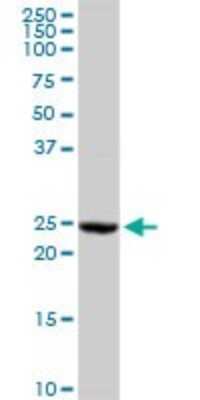 Western Blot: GSTA2 Antibody [H00002939-D01P]