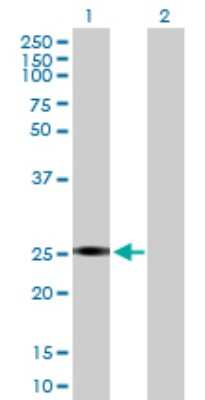 Western Blot: GSTA2 Antibody [H00002939-D01P]