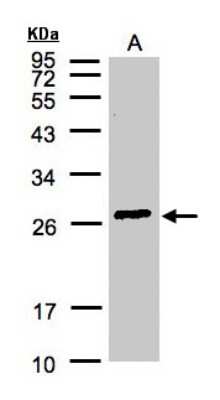 Western Blot: GSTA2 Antibody [NBP1-32157]