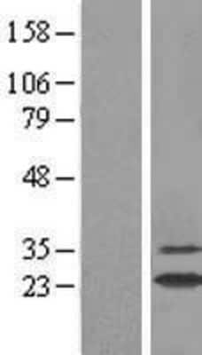 Western Blot: GSTA2 Overexpression Lysate [NBL1-11367]