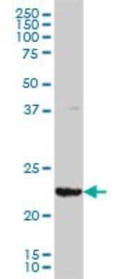 Western Blot: GSTA3 Antibody (1F11) [H00002940-M01]