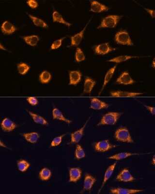 Immunocytochemistry/ Immunofluorescence: GSTA3 Antibody - Azide and BSA Free [NBP3-04545]