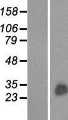 Western Blot: GSTA3 Overexpression Lysate [NBP2-08995]