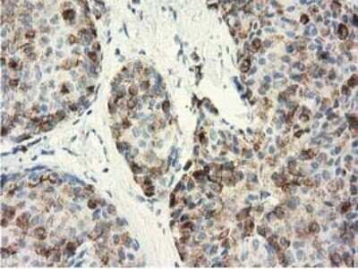 Immunohistochemistry: GSTA4 Antibody (OTI3F5) - Azide and BSA Free [NBP2-70856]