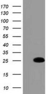 Western Blot: GSTA4 Antibody (OTI3F5)Azide and BSA Free [NBP2-70856]