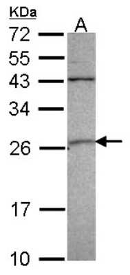 Western Blot: GSTA4 Antibody [NBP1-32229]