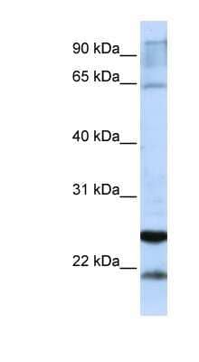 Western Blot: GSTA4 Antibody [NBP1-54817]