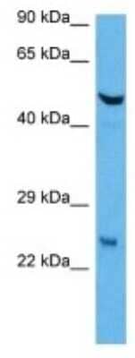 Western Blot: GSTA4 Antibody [NBP3-10114]