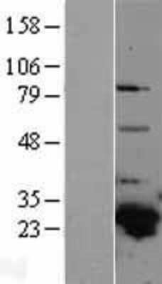 Western Blot: GSTA4 Overexpression Lysate [NBL1-11369]