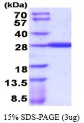 SDS-PAGE: Recombinant Human GSTA4 His Protein [NBP2-52144]