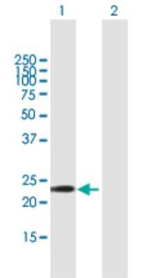 Western Blot: GSTA5 Antibody [H00221357-B01P]