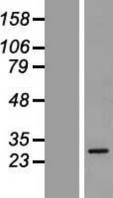 Western Blot: GSTA5 Overexpression Lysate [NBP2-05232]