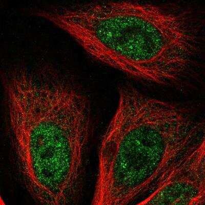 Immunocytochemistry/ Immunofluorescence: GSTCD Antibody [NBP2-76556]