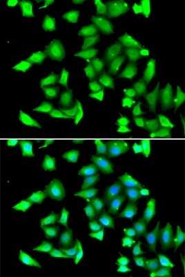 Immunocytochemistry/ Immunofluorescence: GSTCD Antibody - BSA Free [NBP3-04623]