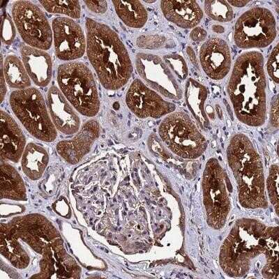 Immunohistochemistry-Paraffin: GSTCD Antibody [NBP1-91972]