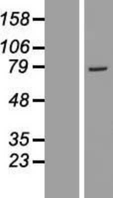 Western Blot: GSTCD Overexpression Lysate [NBL1-11370]