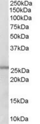 Western Blot: Glutathione S-Transferase mu 1/GSTM1 Antibody [NB300-932]