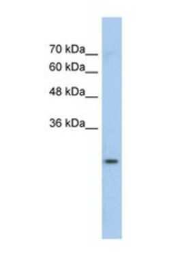 Western Blot: Glutathione S-Transferase mu 1/GSTM1 Antibody [NBP1-58377]