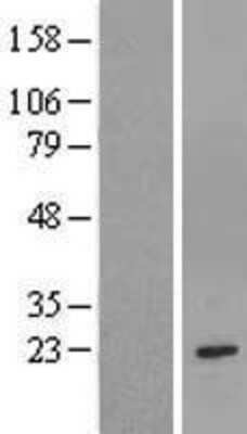 Western Blot: Glutathione S-Transferase mu 1/GSTM1 Overexpression Lysate [NBL1-11372]