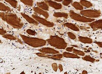 Immunohistochemistry-Paraffin: GSTM2 Antibody (005) [NBP2-90039]